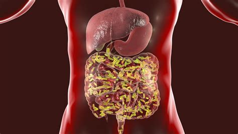 Gut Microbiome Can Trigger Sickle Cell Disease Complications Inside