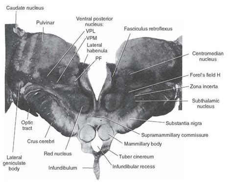 Photograph Of A Section Taken Through The Caudal Third Of The Thalamus