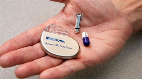 A pacemaker is a small electronic device for treating heart conditions, such as arrhythmias. With FDA approval, Irish implant jolts pacemaker field ...