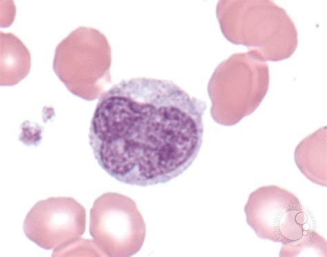 Monocyte 1