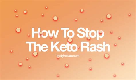 Rash can also persist if there are continued exposures to the food in question. How to STOP the Annoying Keto RASH (Everything You Need To ...