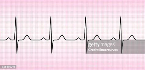 Ecg Wave Photos And Premium High Res Pictures Getty Images