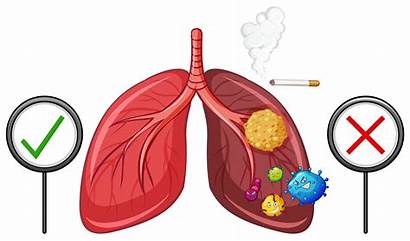Lungs Healthy Unhealthy Diagram Vector Showing Illustration