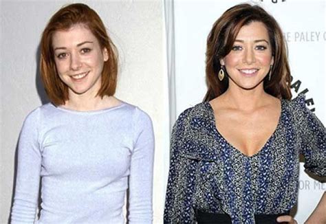 Alyson Hannigan Plastic Surgery Before And After Alyson Celebritybefore