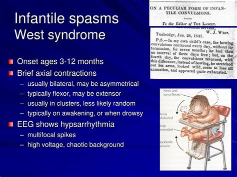 Ppt Pediatric Epilepsy An Overview And Update On Treatment Options