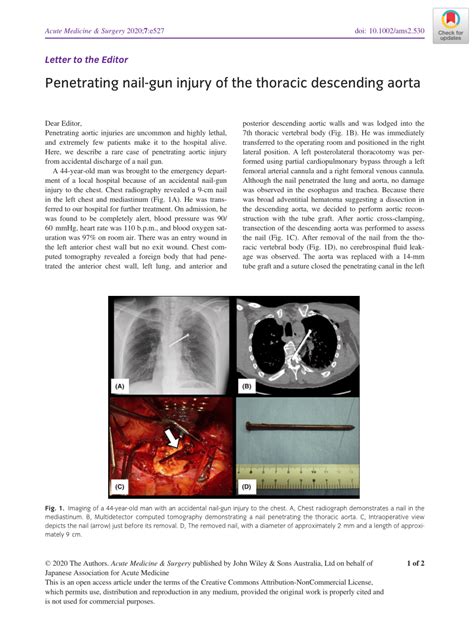 Pdf Penetrating Nail‐gun Injury Of The Thoracic Descending Aorta