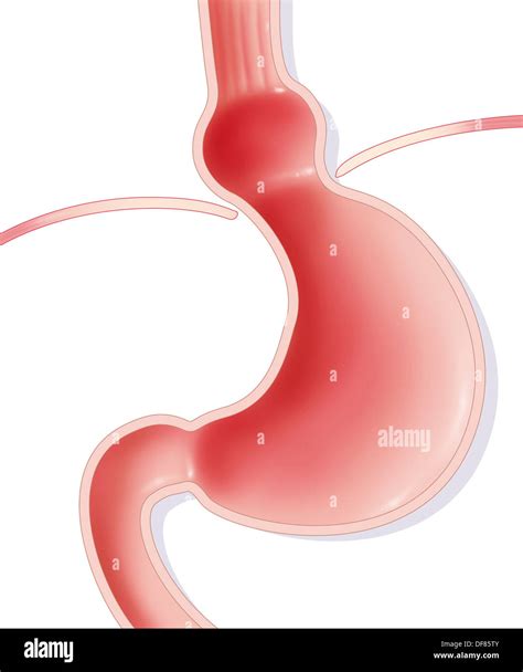 Hiatal Hernia Hi Res Stock Photography And Images Alamy