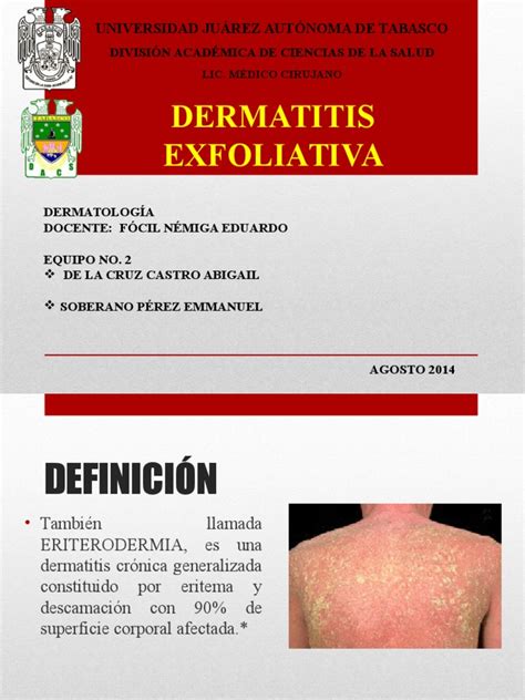 Dermatitis Exfoliativa Pdf Dermatología Inmunología