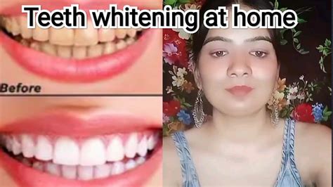 Teeth Whitening At Home 🌼🌼🌼🌼 Youtube