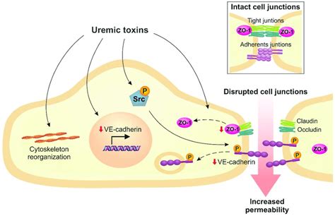 Uremic Toxins Lead To The Loss Of Intercellular Junctions Which