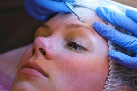 Mechanical Cleaning Of The Face At The Beautician Cosmetologist