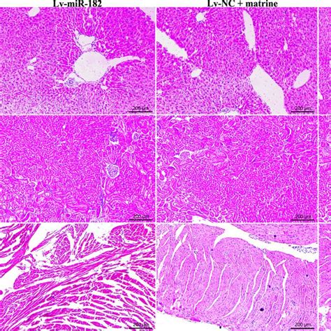 Histopathological Analysis Of Mouse Livers Kidneys And Hearts By