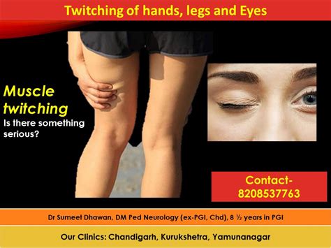 Muscle Twitching Treatment And Causes Dr Sumeet Dhawan Neurologist
