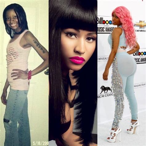 Nicki Minaj Before And After Plastic Surgery Terrys Blog