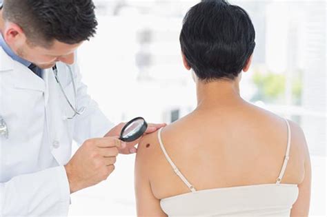 Skin Cancer Screening And Treatment Andover Dermatology Exceptional