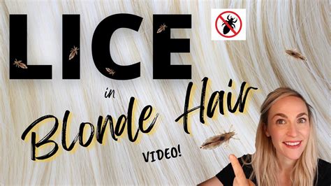 How To Check For Lice In Blonde Hair 10 Signs Beezzly