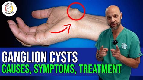 Ganglion Cysts Causes Symptoms Treatments Youtube