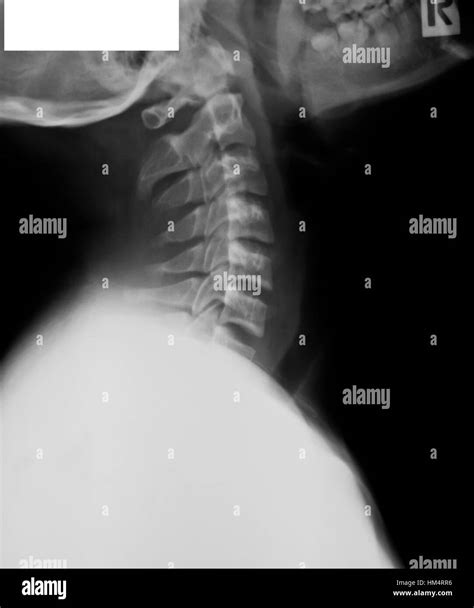 Collection Of X Ray Stock Photo Alamy