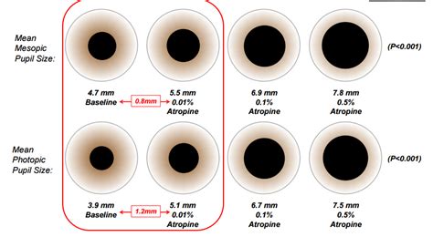 Atropine And Myopia Control The Atom 2 Study Eyedolatry