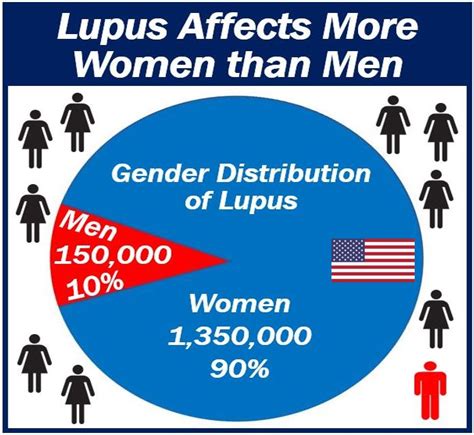 Lupus Affects More Women Than Men Why New Study Explores