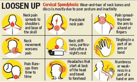 Cervical Spondylosis Symptoms Cure And Prevention For Neck Pain