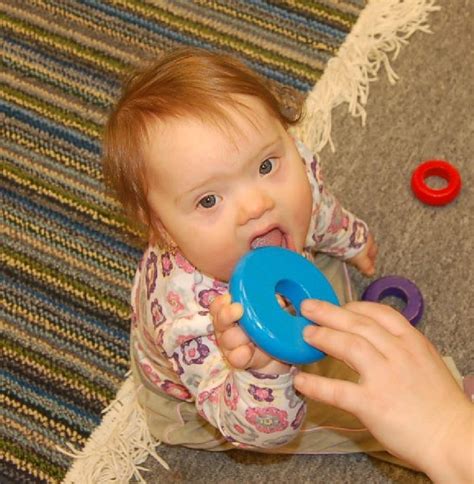 Downův syndrom je spojen se zvýšeným rizikem mnoha chronických onemocnění, která downův syndrom je nejčastější chromozomální abnormalitou u lidí. Ovečka