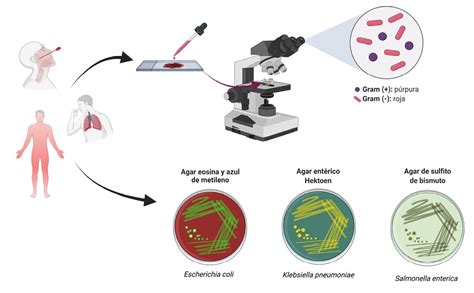 Diagnóstico De Enfermedades Bacterianas Evolución De Técnicas