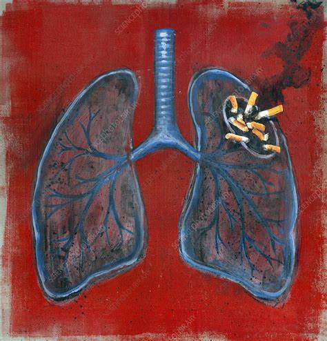 illustration of lungs and cigarettes stock image f019 5333 science photo library