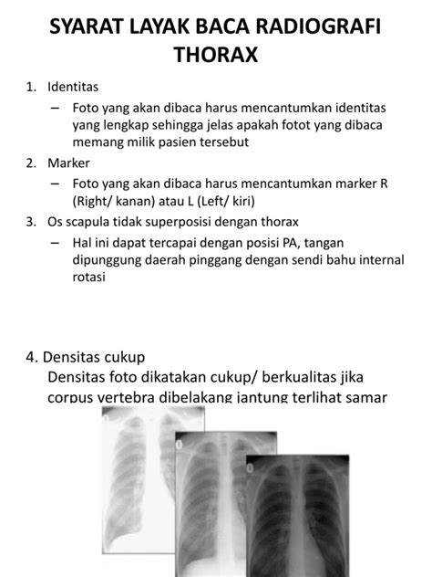 Radiologi Thorax And Bronkhitiss Pdf