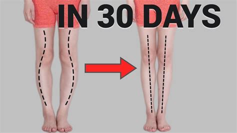 Get Straight Legs In 30 Days Fix O Or X Shaped Legs Knee Internal
