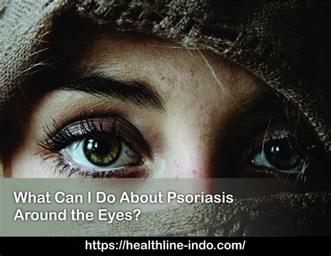 What Can I Do About Psoriasis Around The Eyes Healthline Indonesia