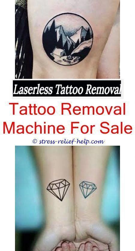 Leave the solution on the skin for a few minutes, then grab a clean wash cloth and begin rubbing that tattoo vigorously. How to remove tattoos at home for free.Can tattoos be ...