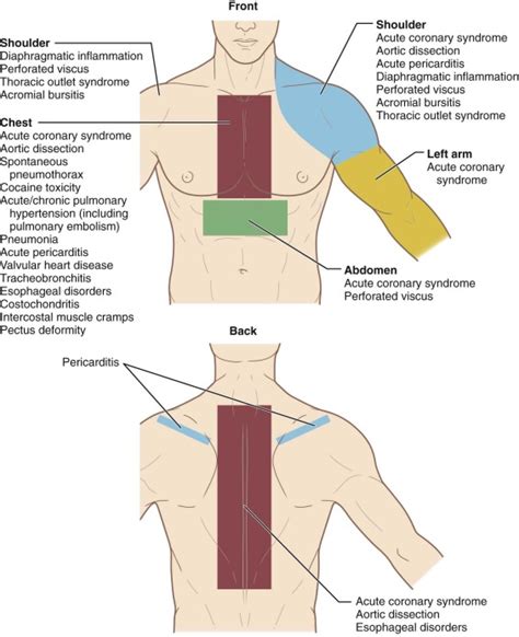 Chest Pain Thoracic Key