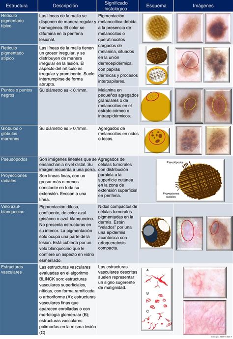 Dermatoscopia Para Principiantes Ii Estructuras Dermatoscópicas Y