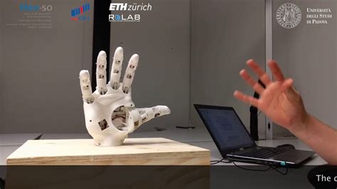 Myoelectric Control Of A 3D Printed Prosthetic Hand YouTube