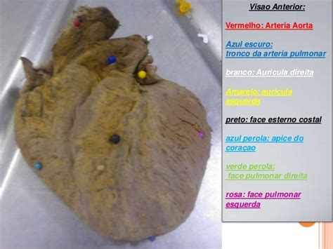 Imagem Do Sistema Circulatorio Do Manual De Cn Do 6 Ano
