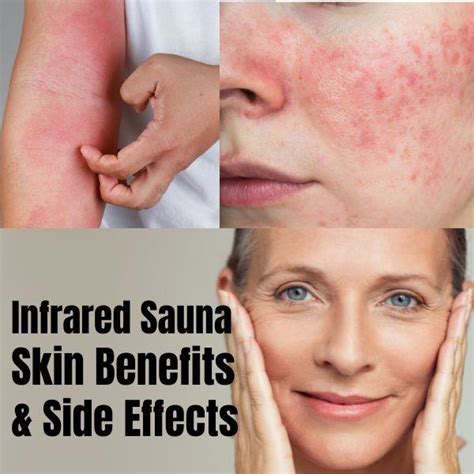 5 Infrared Sauna Skin Benefits Side Effects