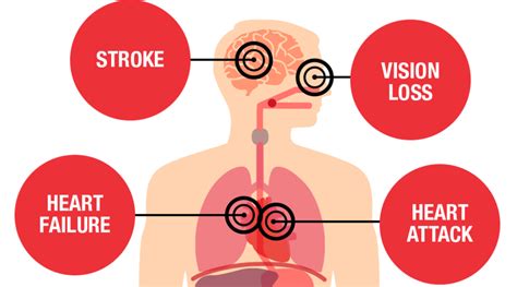 Fluctuating blood pressure can be caused by exercise, digestion, and even just relaxation. High Blood Pressure | American Heart Association