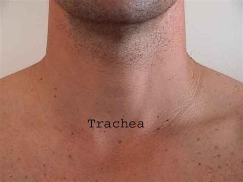 Respiratory examination - wikidoc