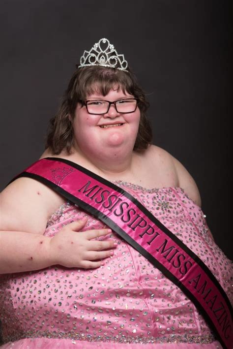 Girl With Rare Condition That Makes Her Constantly Hungry Wins Beauty