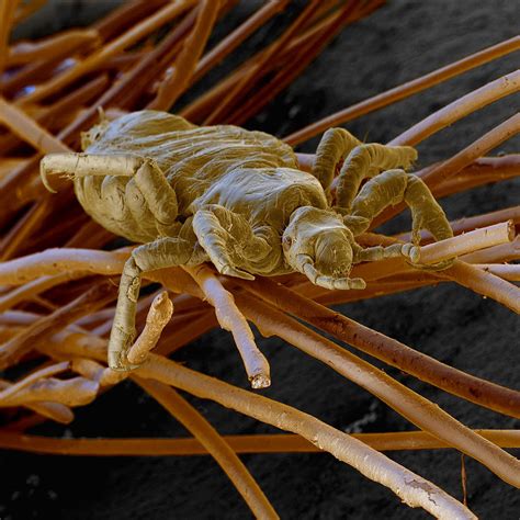 Head Lice Photograph By Eye Of Science