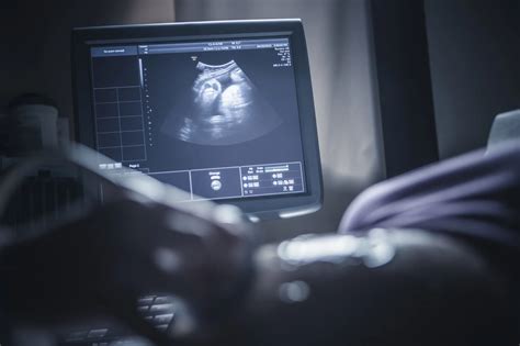 How Much Do Ultrasound Techs Make Heres What We Know