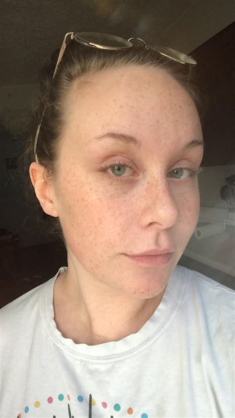 what do you think r freckledgirls