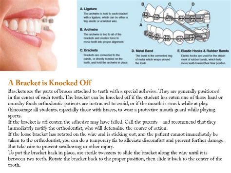 Orthodontic Emergencies Steps For Orthodontic Emergencies
