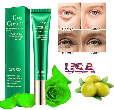 Best Under Eye Cream Remove Dark Circles Wrinkles Anti Aging Puffy Eye Usa Ebay