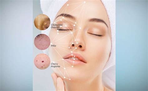 Removal Skin Irregulaties Touch Of Joy Skin Health