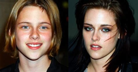 Celebuzz Ugly Duckling Celebrities Through Years