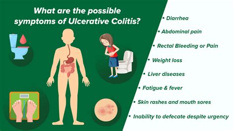 Ulcerative Colitis Rash Here S How To Deal With These Symptoms