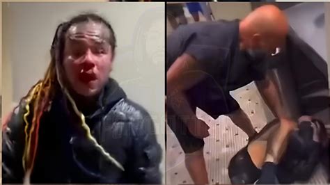 Rapper 6ix9ine Face Broken After Getting JUMPED ROBBED While Working