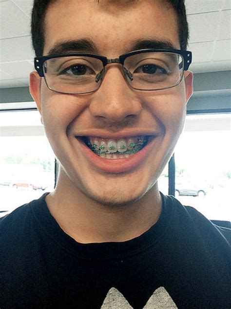 Glasses And Braces The Perfect Combination Perfect Teeth Metal Braces